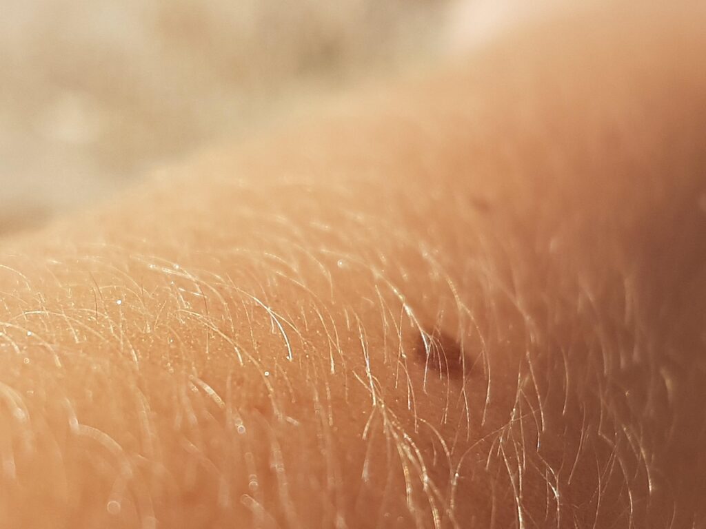 30代ママが脱毛で痛みを感じにくい時間帯はいつ？