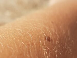 30代ママが脱毛で痛みを感じにくい時間帯はいつ？